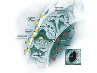 Mars membrane